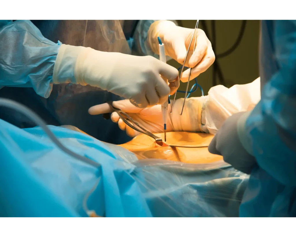 uses of laparoscopy in gynecology